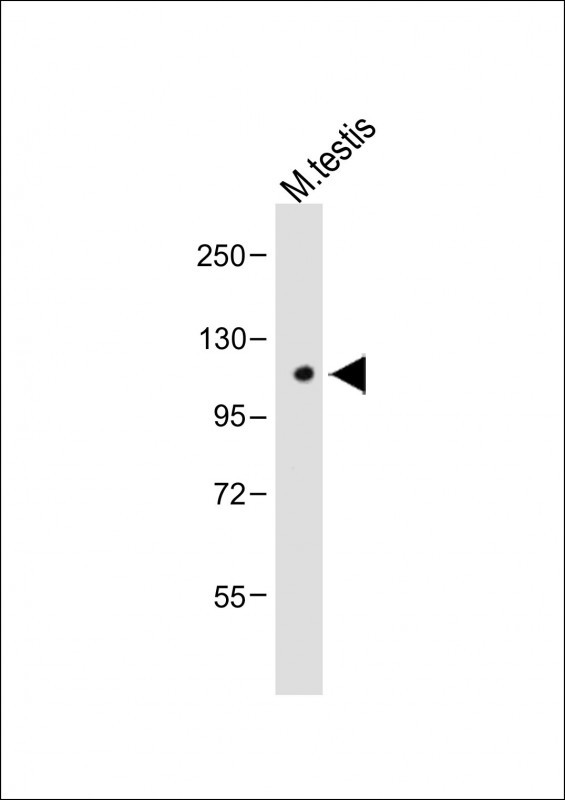 WB - Mouse Cdk13 Antibody (N-term) AP14952a