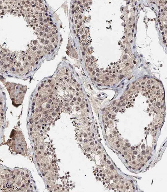 IHC-P - BRD9 Antibody (N-term) AP18588A