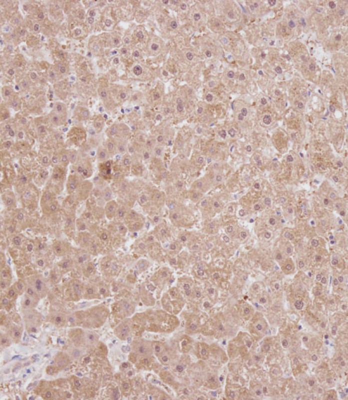 IHC-P - RS18 Antibody (Center) AP6887c