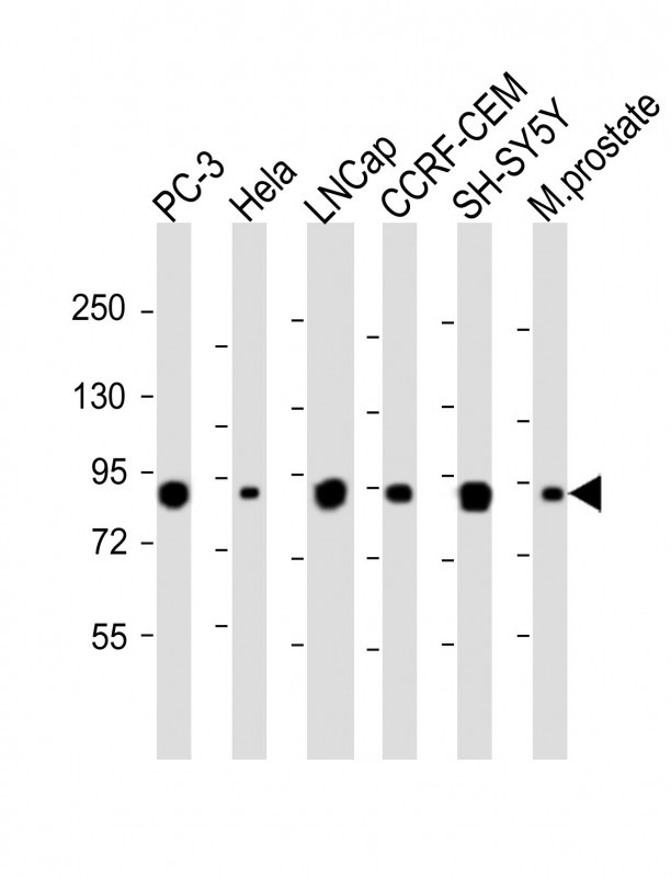 WB - TGM4 Antibody (Center) AP6918c