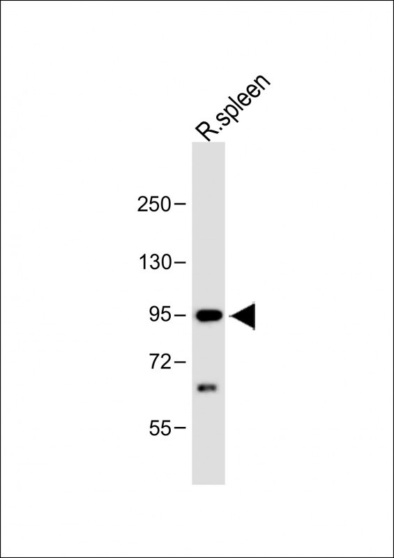 Anti-CBLB Antibody (Center) at 1:1000 dilution + Rat spleen whole tissue lysateLysates/proteins at 20 �g per lane. SecondaryGoat Anti-Rabbit IgG,  (H+L), Peroxidase conjugated at 1/10000 dilution. Predicted band size : 109 kDaBlocking/Dilution buffer: 5% NFDM/TBST.