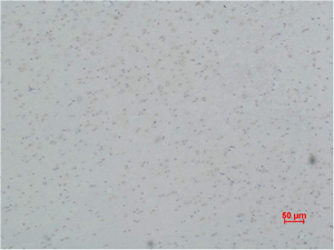 IHC - L-type Ca++ CP γ5 Polyclonal Antibody AP63547