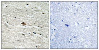 IHC - HMG-14 (phospho Ser21) Polyclonal Antibody AP68085