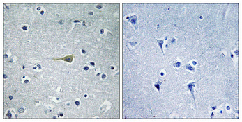 IHC - CA VB Polyclonal Antibody AP68760
