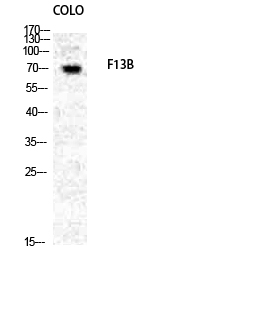 IHC - Factor XIII B Polyclonal Antibody AP69837