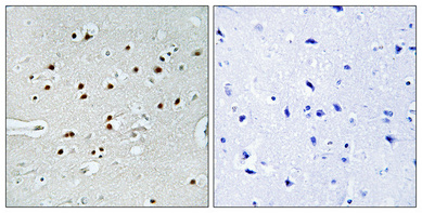 IHC - MRTF-A Polyclonal Antibody AP71078