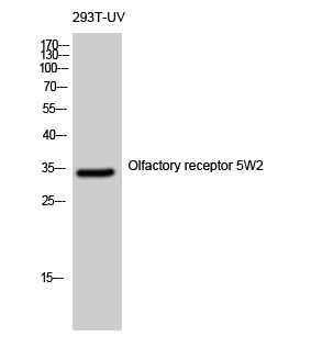 WB - Olfactory receptor 5W2 Polyclonal Antibody AP71604