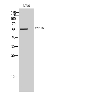 WB - RNF15 Polyclonal Antibody AP72340