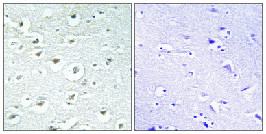 IHC - RoXaN Polyclonal Antibody AP72351