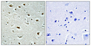 IHC - SRE-ZBP Polyclonal Antibody AP72596