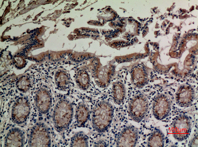 IHC - TRPV3 Polyclonal Antibody AP73278