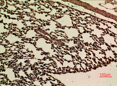 IHC - JAM-B Polyclonal Antibody AP73298