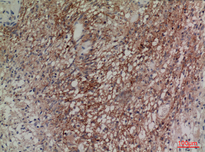 IHC - Neuregulin-2 Polyclonal Antibody AP73398