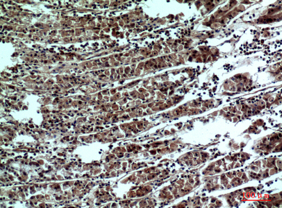 IHC - PPP1R15B Polyclonal Antibody AP73754