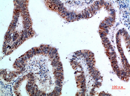 IHC - TyrRS Polyclonal Antibody AP73981