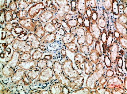 IHC - TyrRS Polyclonal Antibody AP73981