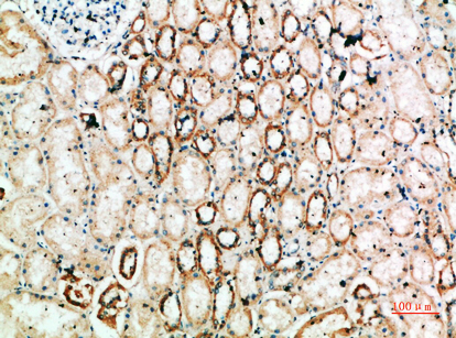 IHC - TyrRS Polyclonal Antibody AP73981