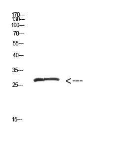 WB - MYOZ2 Polyclonal Antibody AP74010