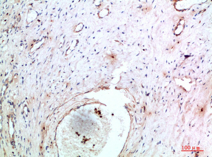 IHC - Abin-2 Polyclonal Antibody AP74170