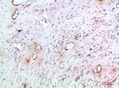 IHC - Abin-2 Polyclonal Antibody AP74170