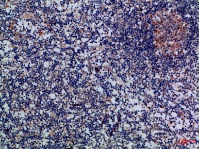IHC - Granzyme M Polyclonal Antibody AP74232