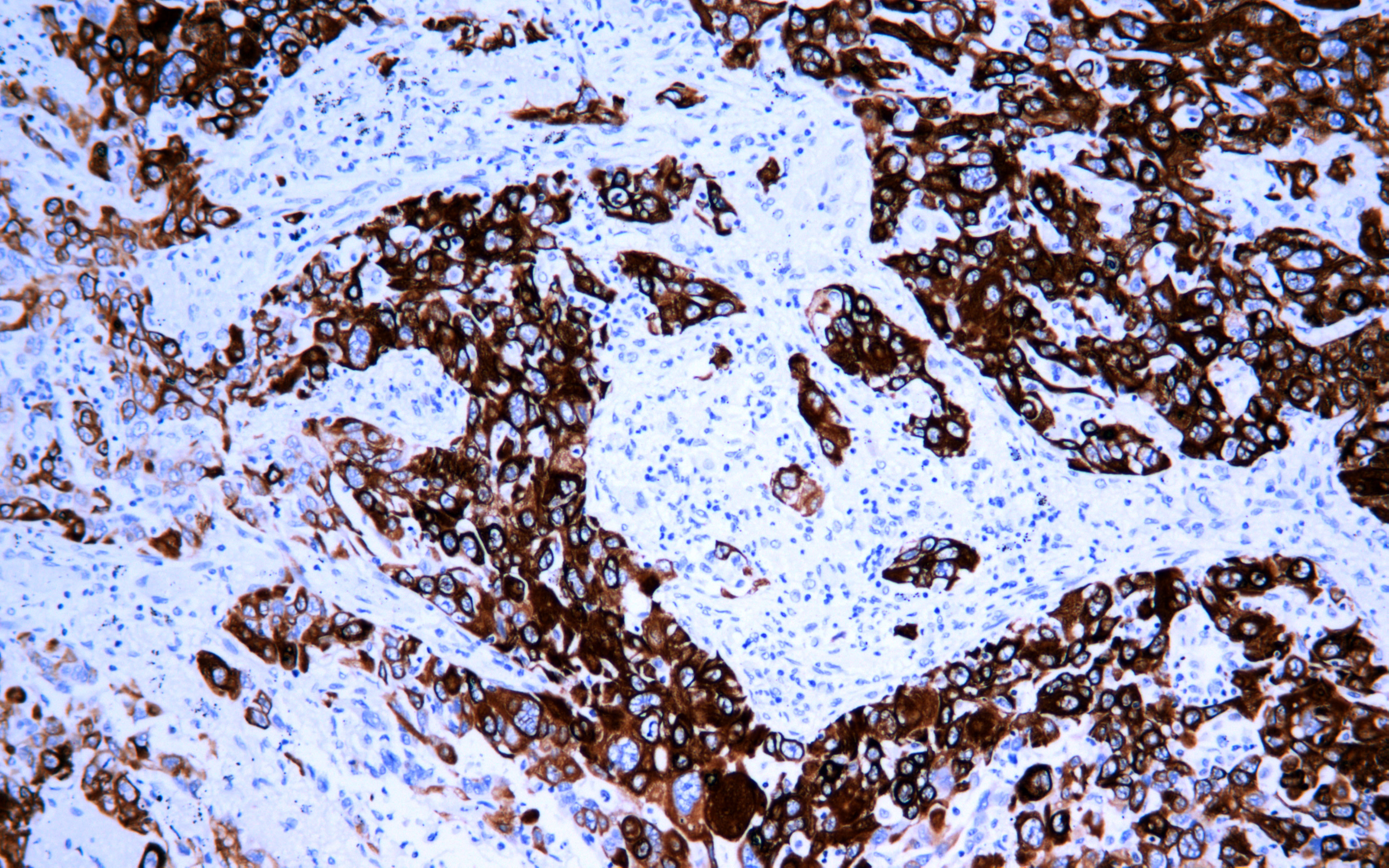 IHC - CK6 AD80226-010