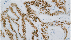 IHC-P - SATB2 AD80202-010