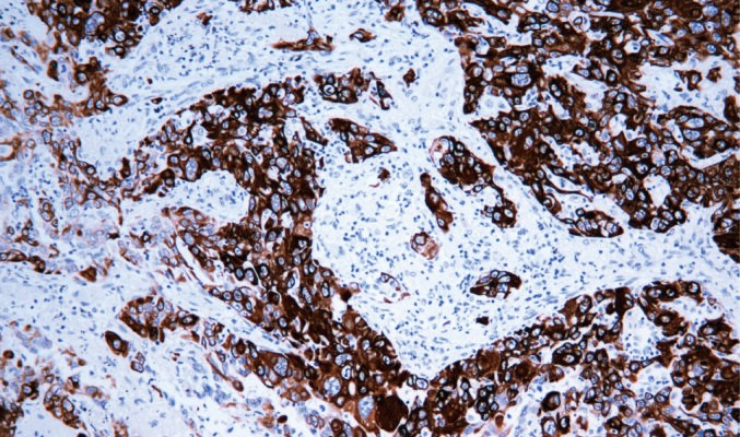 IHC-P - CK6 AD80226-010