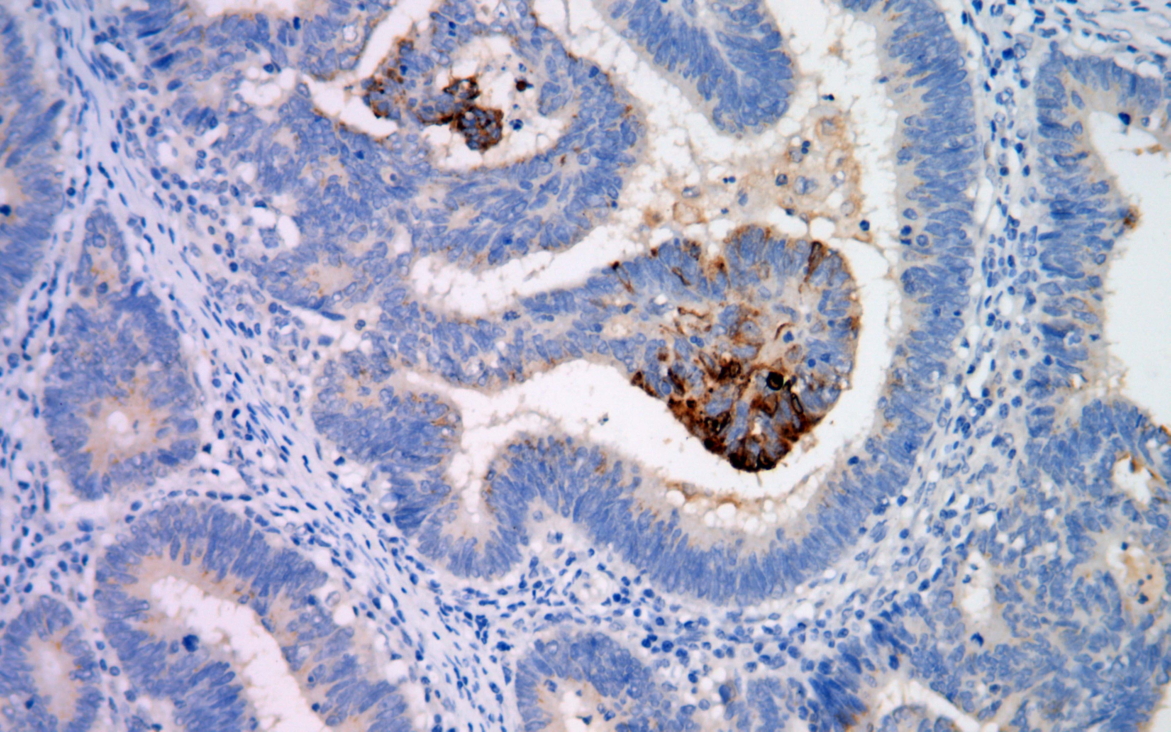 IHC - TAG-72 AD80150-010