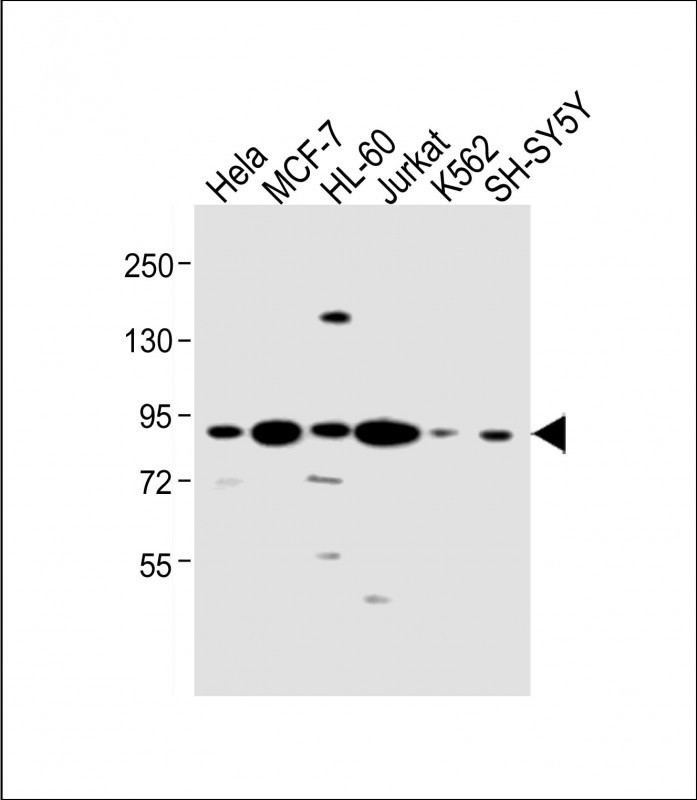 All lanes : Anti-CCNT1 Antibody (Center) at 1:1000 dilutionLane 1: Hela whole cell lysateLane 2: MCF-7 whole cell lysateLane 3: HL-60 whole cell lysateLane 4: Jurkat whole cell lysateLane 5: K562 whole cell lysateLane 6: SH-SY5Y whole cell lysateLysates/proteins at 20 �g per lane. SecondaryGoat Anti-Rabbit IgG,  (H+L), Peroxidase conjugated at 1/10000 dilution. Predicted band size : 81 kDaBlocking/Dilution buffer: 5% NFDM/TBST.