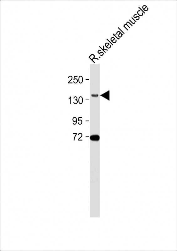 WB - BCORL1 Antibody (N-term) AP10847a