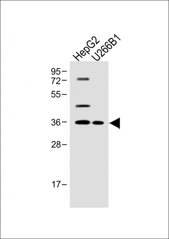 WB - FOLR4 Antibody (N-term) AP11990a