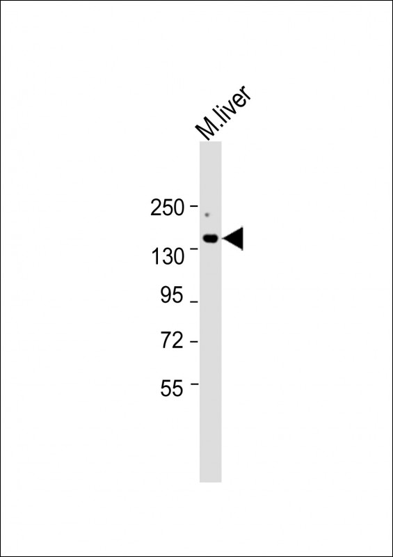 Anti-ATP7B Antibody (C-term) at 1:2000 dilution + Mouse liver lysateLysates/proteins at 20 �g per lane. SecondaryGoat Anti-Rabbit IgG,  (H+L), Peroxidase conjugated at 1/10000 dilution. Predicted band size : 157 kDaBlocking/Dilution buffer: 5% NFDM/TBST.