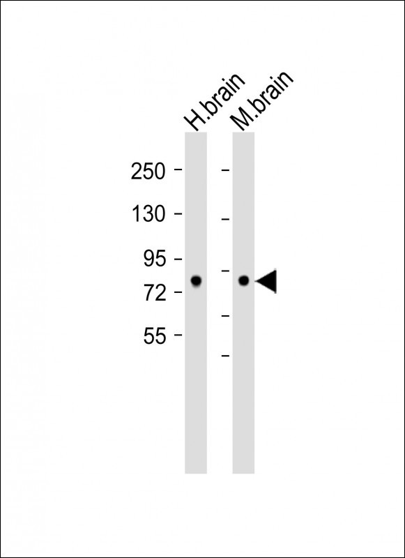 WB - DCAMKL1 Antibody (C-term) AP7219B
