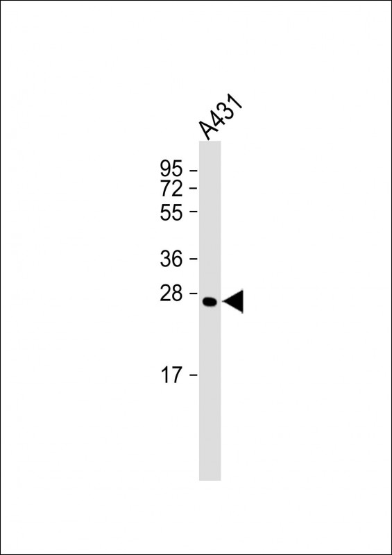 Anti-CAPNS1 Antibody at 1:4000 dilution + A431 whole cell lysateLysates/proteins at 20 �g per lane. SecondaryGoat Anti-Rabbit IgG,  (H+L), Peroxidase conjugated at 1/10000 dilution. Predicted band size : 28 kDaBlocking/Dilution buffer: 5% NFDM/TBST.