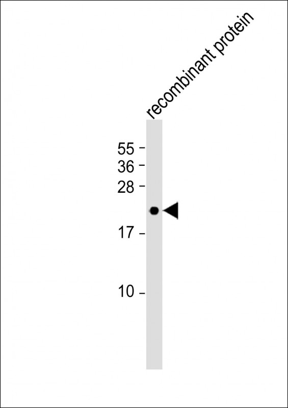 Anti-FGF4 Antibody at 1:4000 dilution + recombinant protein lysateLysates/proteins at 20 �g per lane. SecondaryGoat Anti-Rabbit IgG,  (H+L), Peroxidase conjugated at 1/10000 dilution. Predicted band size : 19 kDaBlocking/Dilution buffer: 5% NFDM/TBST.