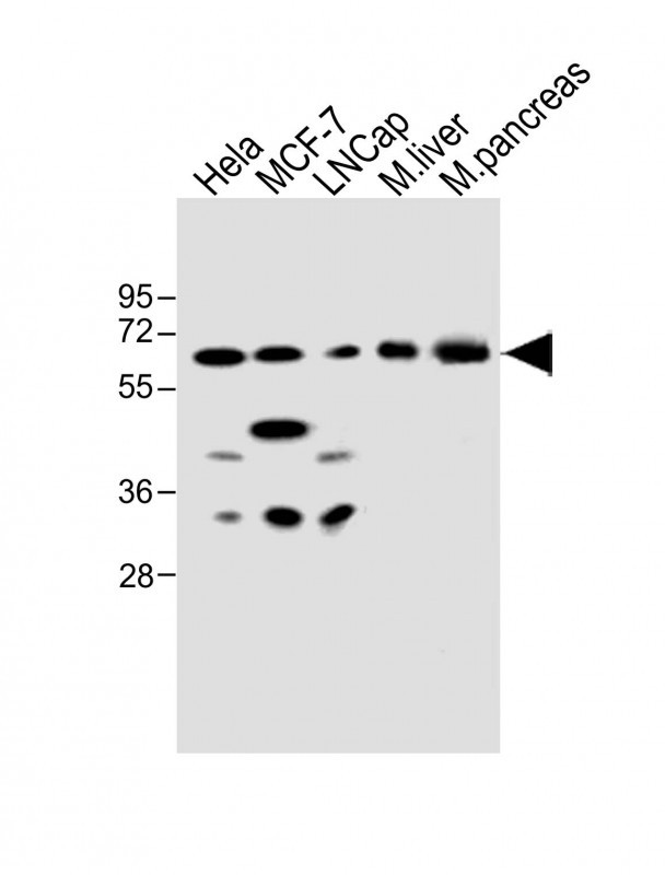 All lanes : Anti-CBS Antibody (Center) at 1:500 dilutionLane 1: Hela whole cell lysateLane 2: MCF-7 whole cell lysateLane 3: LNCap whole cell lysateLane 4: mouse liver lysateLane 5: mouse pancreas lysateLysates/proteins at 20 �g per lane. SecondaryGoat Anti-Rabbit IgG,  (H+L), Peroxidase conjugated at 1/10000 dilution. Predicted band size : 61 kDaBlocking/Dilution buffer: 5% NFDM/TBST.
