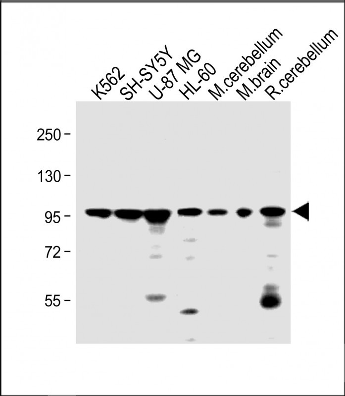 All lanes : Anti-DNAJC6 Antibody (Center) at 1:2000 dilutionLane 1: K562 whole cell lysateLane 2: SH-SY5Y whole cell lysateLane 3: U-87 MG whole cell lysateLane 4: HL-60 whole cell lysateLane 5: mouse cerebellum lysateLane 6: mouse brain lysateLane 7: rat cerebellum lysateLysates/proteins at 20 �g per lane. SecondaryGoat Anti-Rabbit IgG,  (H+L), Peroxidase conjugated at 1/10000 dilution. Predicted band size : 100 kDaBlocking/Dilution buffer: 5% NFDM/TBST.