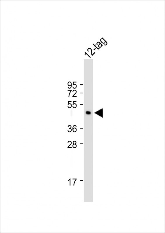 All lanes : Anti-FLAG tag antibody (DYKDDDDK) at 1:2000 dilutionLane 1: 12-tag recombinant protein                                                                                                                                                                                                                                                                                                                                                                                                                                                                                    Lysates/proteins at 20 �g per lane. SecondaryGoat Anti-Rabbit IgG,  (H+L), Peroxidase conjugated at 1/10000 dilution. Observed band size : 50 kDaBlocking/Dilution buffer: 5% NFDM/TBST.