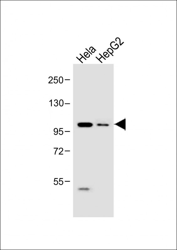 All lanes : Anti-LGR5 antibody (N-term) at 1:1000 dilutionLane 1: Hela whole cell lysate  Lane 2: HepG2 whole cell lysate                                                                                                                                                                                                                                                                                                                                                                                                                                                                                     Lysates/proteins at 20 �g per lane. SecondaryGoat Anti-Rabbit IgG,  (H+L), Peroxidase conjugated at 1/10000 dilution. Observed band size : 100 kDaBlocking/Dilution buffer: 5% NFDM/TBST.