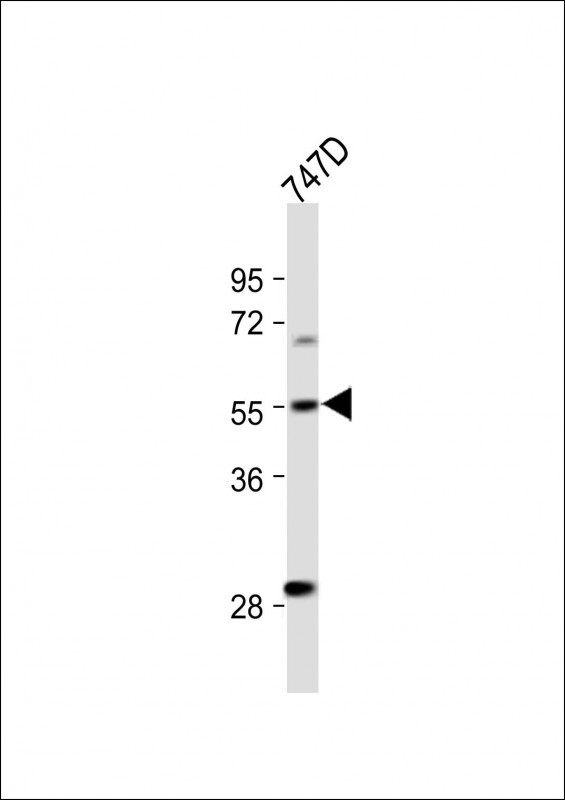 All lanes : Anti-CYP27B1 Antibody (C-term) at 1:500 dilutionLane 1: T47D whole cell lysate                                                                                                                                                                                                                                                                                                                                                                                                                                                                                       Lysates/proteins at 20 �g per lane. SecondaryGoat Anti-Rabbit IgG,  (H+L), Peroxidase conjugated at 1/10000 dilution. Predicted band size : 57 kDaBlocking/Dilution buffer: 5% NFDM/TBST.