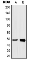 WB - Anti-hnRNP H Antibody AP53679