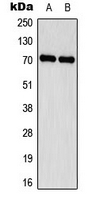 WB - Anti-Delta-NaCH Antibody AP53779