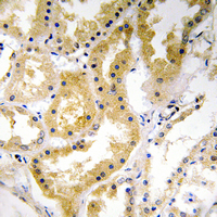 - Anti-ABHD4 Antibody AP53839