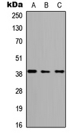 WB - Anti-ABHD4 Antibody AP53839