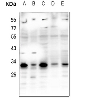 WB - Anti-RNF138 Antibody AP53865