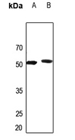 WB - Anti-AGXT2L2 Antibody AP53917