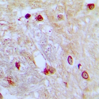 - Anti-ZNF392 Antibody AP53950