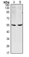 WB - Anti-CCDC102A Antibody AP53962