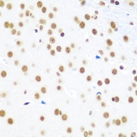 - Anti-EVI1 Antibody AP54063